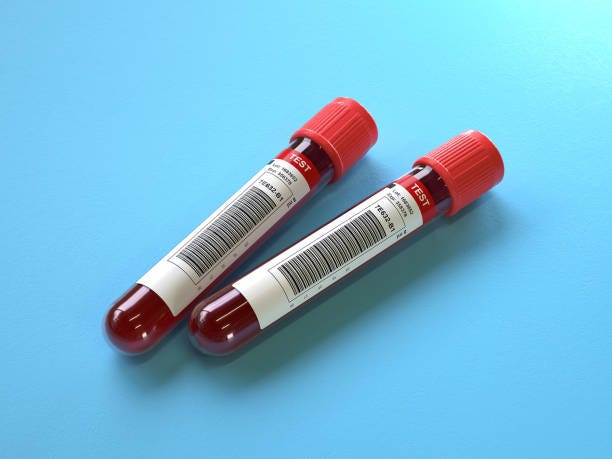 Why Should Healthcare Professionals Rely on AV Consumables Blood Collection Tubes?