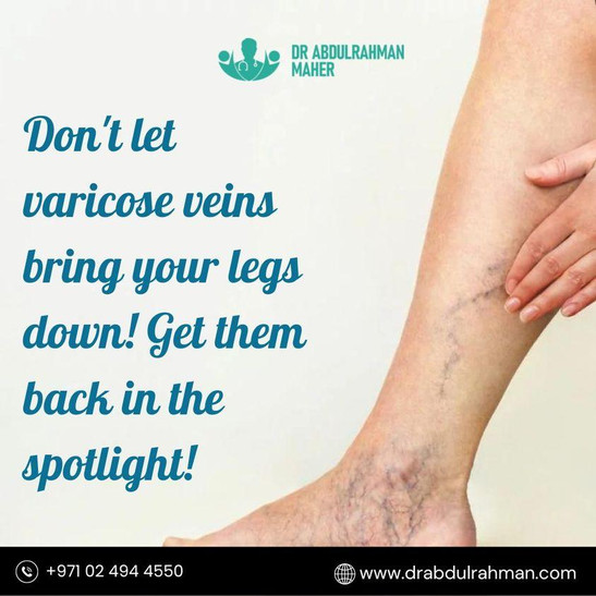 Finding the Best Vascular Surgeon in Abu Dhabi for Varicose Veins Treatment - JustPaste.it