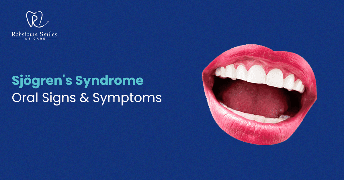 Sjögren's Syndrome: Oral Signs and Symptoms | Robstown Smiles