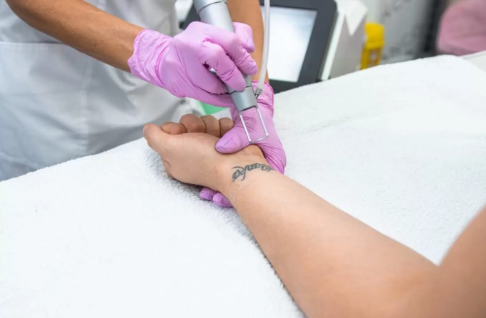 Choosing the Right Tattoo Removal Clinic in London