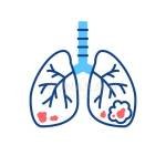 Lung Cancer Profile Picture