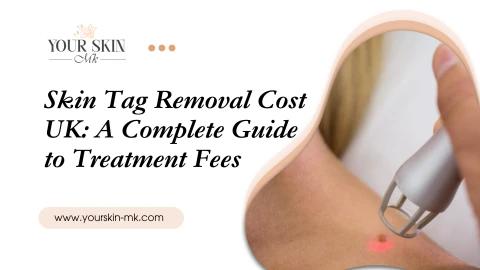 Skin Tag Removal Cost UK A Complete Guide to Treatment Fees