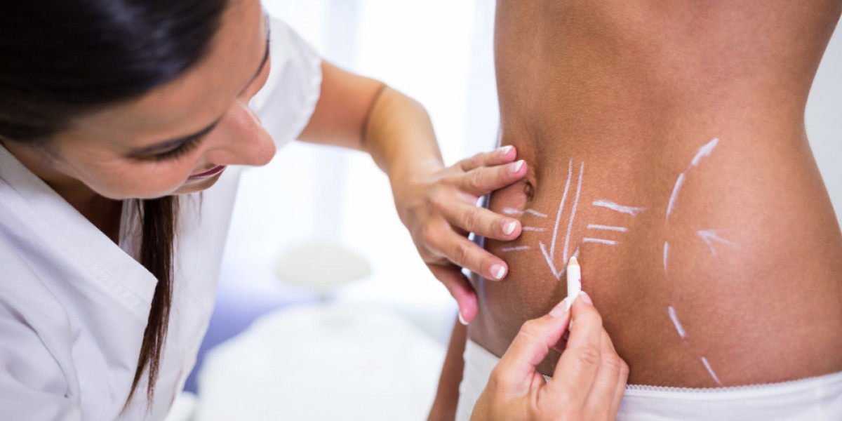 What to Look for When Choosing a Liposuction Surgeon in Jaipur